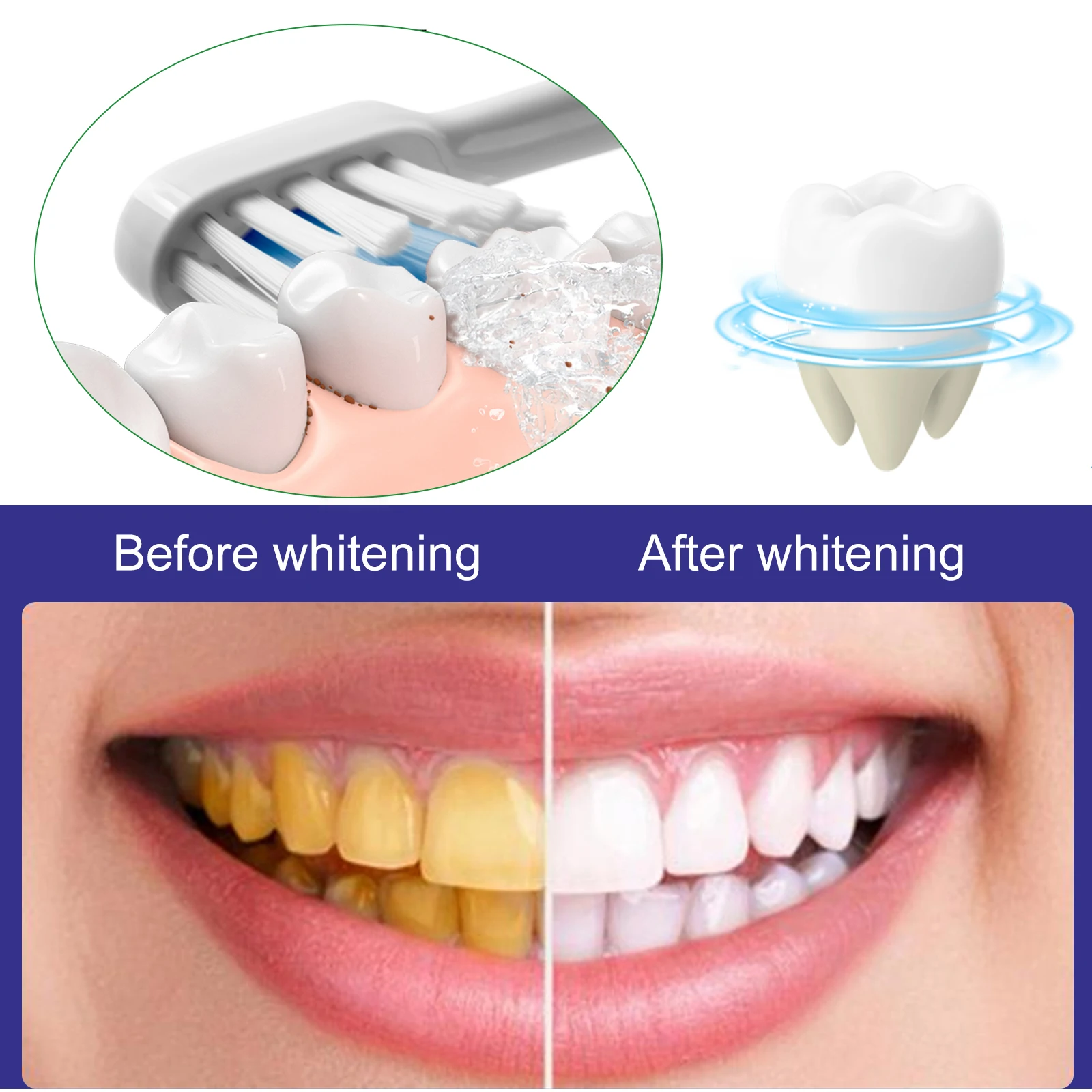 Teeth Cleaning And Whitening Toothpaste Removes Stains, Whitens Teeth,Supports Cavity Treatment And Improves Tooth Bleeding