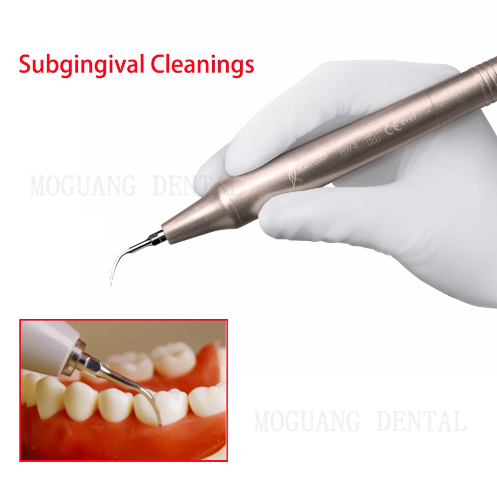 نقار الخشب DTE نصائح قشارة الأسنان بالموجات فوق الصوتية ، دواسات الأسنان ، تحجيم اللبية ، تناسب EMS SATELEC NSK Handpieces ، P PD