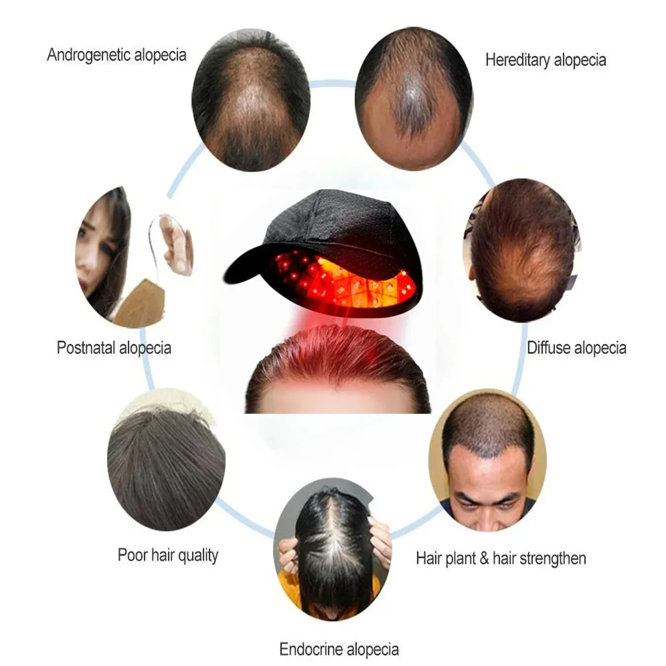 Hair Growth Cap Reduces Oiliness Strengthens Hair Roots Penetrates Deep Into Hair Follicles Relieves Fatigue Anti-Hair Loss Hat