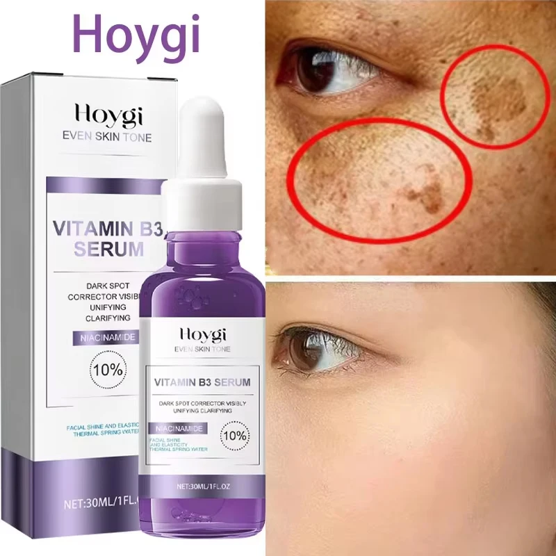 Powerful Dark Spots Remover Whitening Serum Face Freckle Melanin Correcting Anti Pigmentation Brighten Skin Beauty Care Products