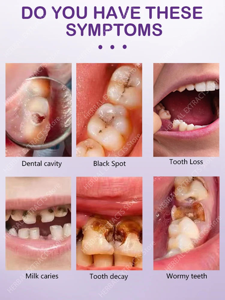 Repara las cavidades, previene la caries de los dientes, elimina la placa, el dolor de dientes, blanquea los dientes, alivia la periodontitis,