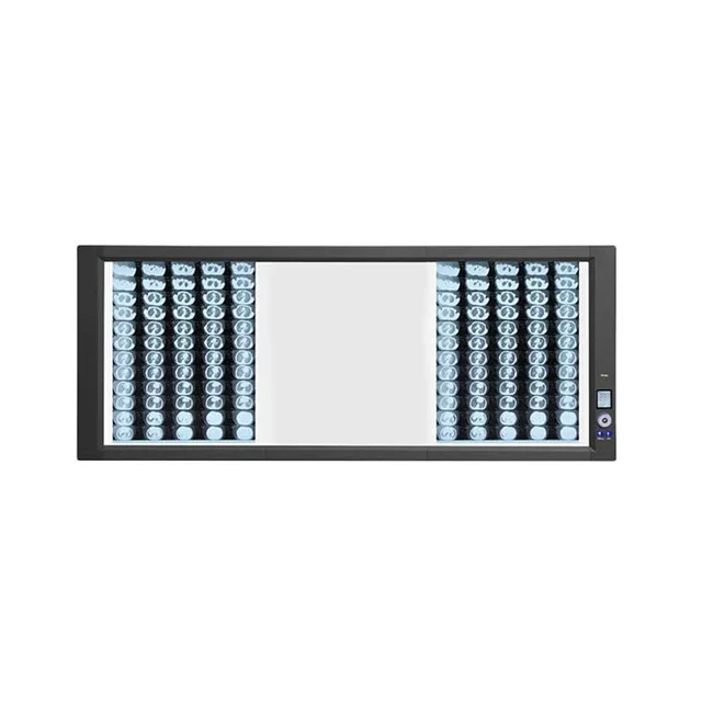 2026/Amcaremed Ultra-Bright LED X-Ray Film Viewer with Back Light Mode Medical Imaging Equipment