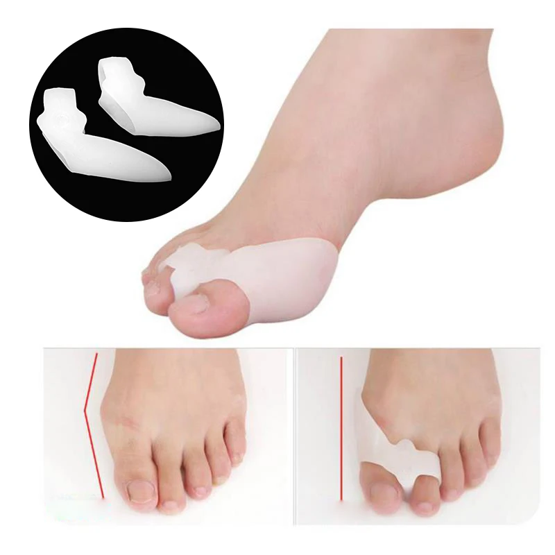 2 pares/lote dedo do pé separador alisador corretor de dedo do pé alívio hálux valgus correção osso polegar ferramentas cuidados com os pés