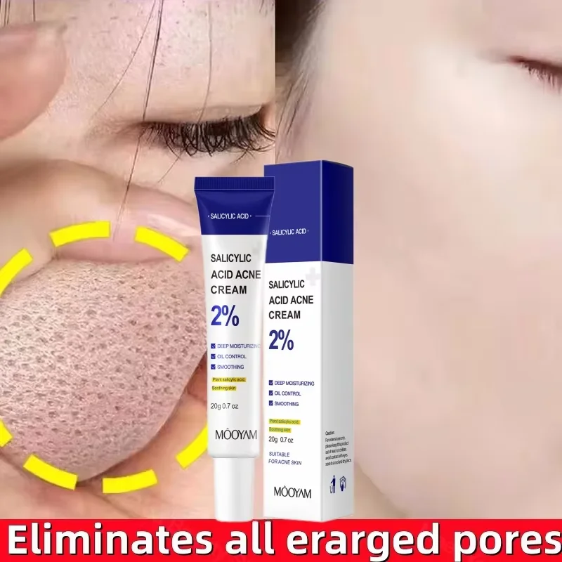 

Salicylic Acid Pore Shrinking Cream Acid Acne Treatment Repair Pimple Spots Oil Control Tighten Face Smooth Skin Korean Product