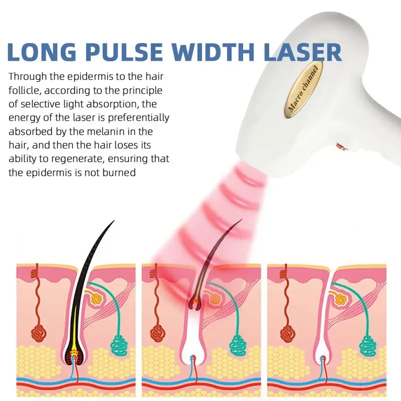Tragbare Eiskühlung 808 Diodenlaser Schmerzlose Haarentfernung 10 Bars Laser Hautverjüngung Permanenter Epilierer Schönheitsausrüstung