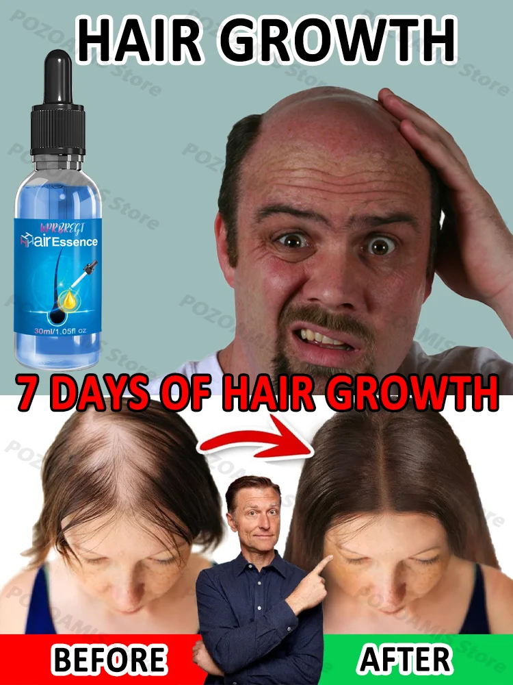 Hot sale, buyers will buy again, hair is getting more and more, say goodbye to baldness, sparse hair starts to become thick