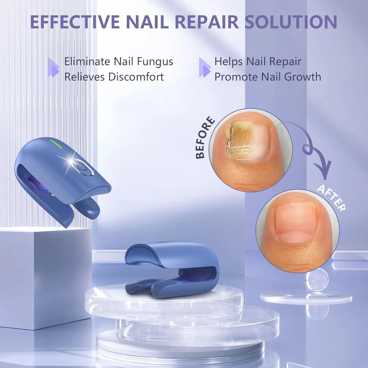 Onychomycosis Nail Fungus 470nm 660nm 905nm Laser Therapy Device Nail Laser Toenail Fingernails Cleaning Use for Nail-Fungus