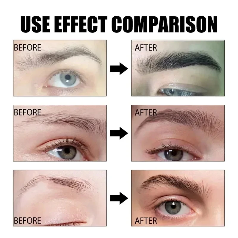 Eyebrow Hair Growth Solution Rapidly Grows Eyebrows And Promotes The Growth Of Hair Follicles Provides Rich Nutritional Elements