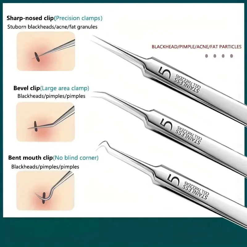 Kit de 3-8 Pièces d'Outils pour l'Acné, Pince à Boutons, Extracteur de Points Noirs en Acier Inoxydable, Clip de Nettoyage de la Peau pour Soins du Visage