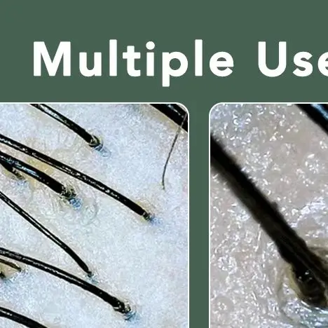 الرقمية HD البصرية اللاسلكية Dermatoscope كشف فروة الرأس المسام المكبر الوجه الجلد محلل الشعر آلة المهنية