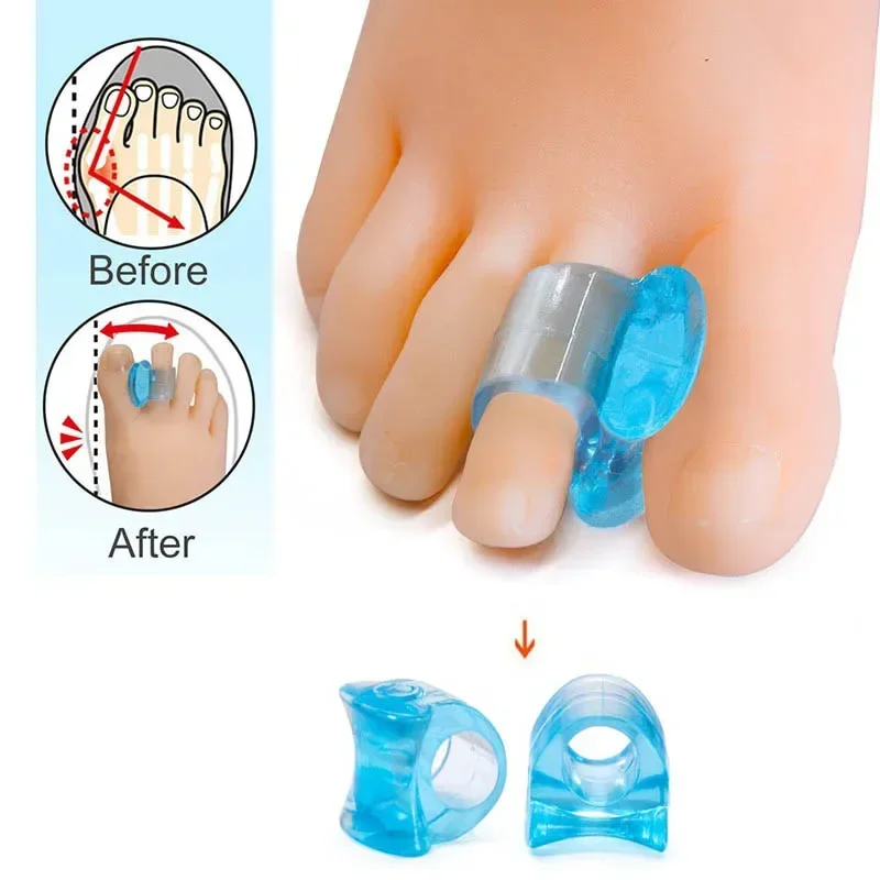 Ортопедические изделия Delysia king Toe