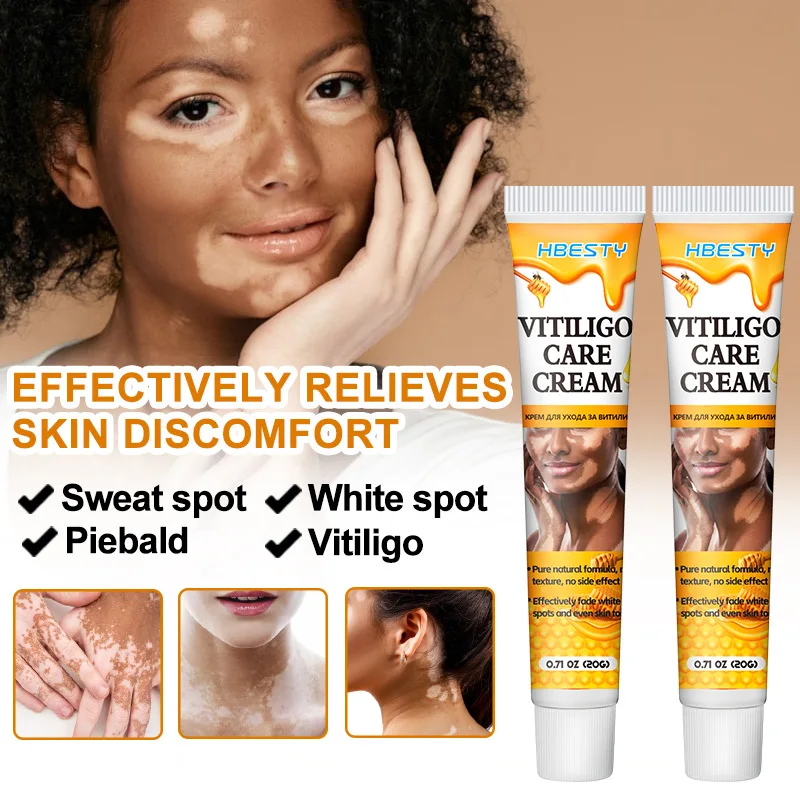 HBESTY-Creme Cuidados Vitiligo