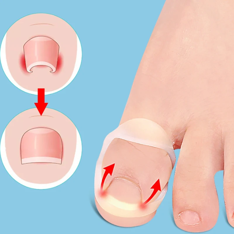 1/2pcs Silicone Ingrown Toenail Correction Tool Invisible Ingrown Toe Nail Straightening Protector Brace Pedicure Feet Care Tool