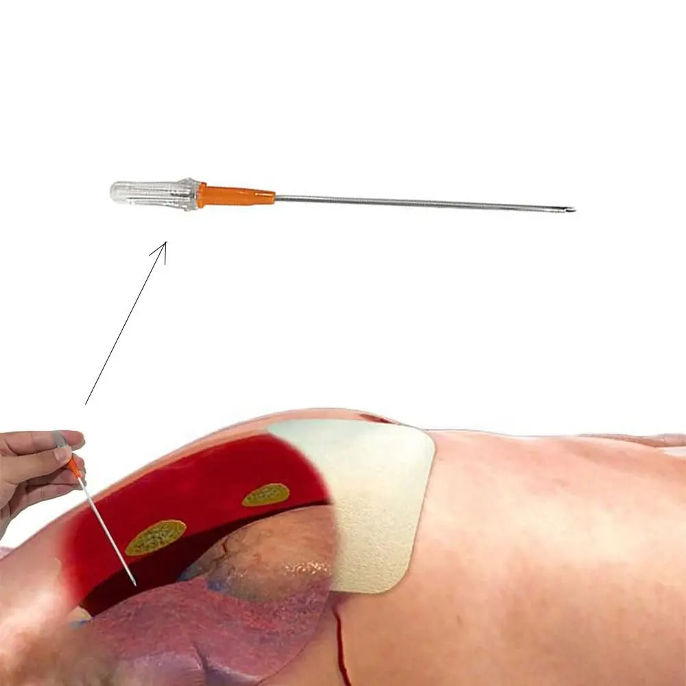 Equipamento de emergência de cor aleatória, kit de primeiros socorros, tensão, pneumotórax, agulha torácica, agulha médica de descompressão no peito