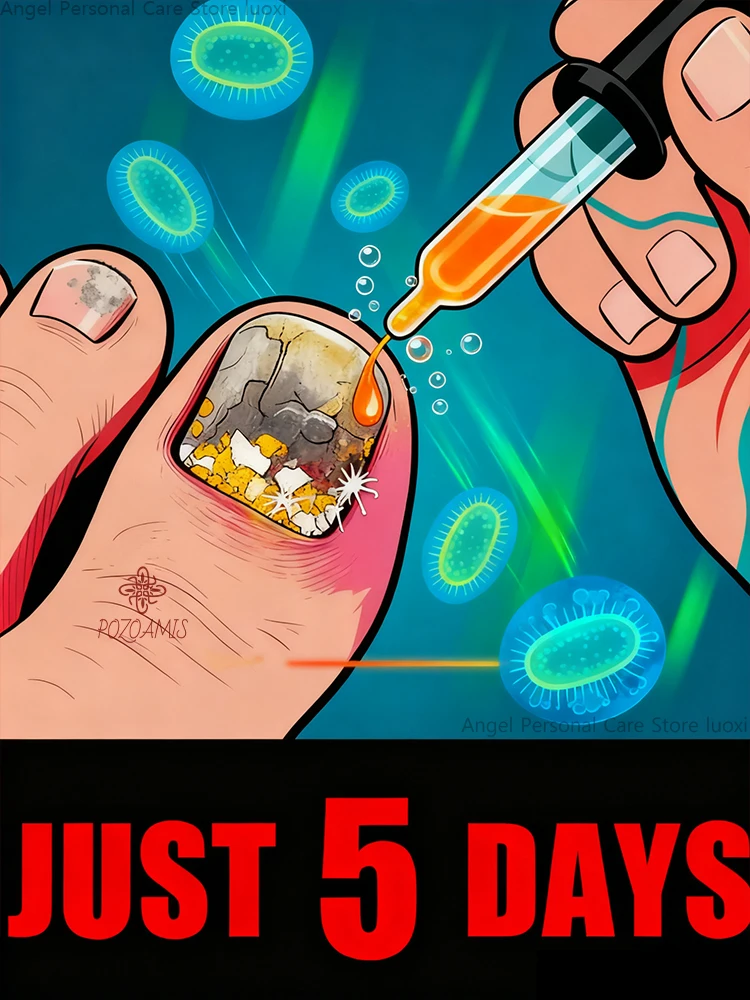 La terapia de penetración de aceite esencial vegetal nutre las uñas de la raíz, dandoá una nueva leasa de la vida.