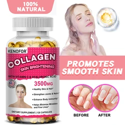 Collagen Supplement with Vitamins and Hyaluronic Acid To Reduce Wrinkles and Fine Lines and Brighten Skin