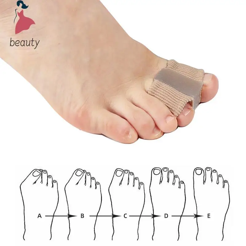 Separador de dedos de silicona para juanete, Corrector de Hallux Valgus, alisador de dedo pulgar, herramienta para el cuidado de los pies, 1 par