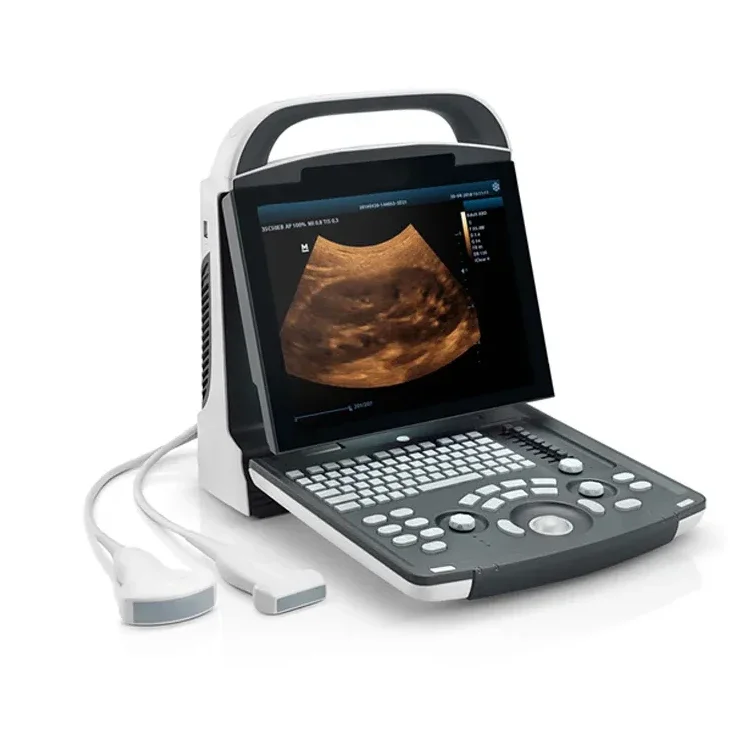 Original Mindray Digital Ultrasonic Diagnostic Imaging System DP-10 Portable B/W Ultrasound Scanner Machine