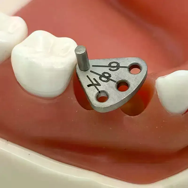 

Dental Implant Parallel Pin Gauge Stainless Steel Medical Locator Dental Implant Locating Guide Locating Ruler