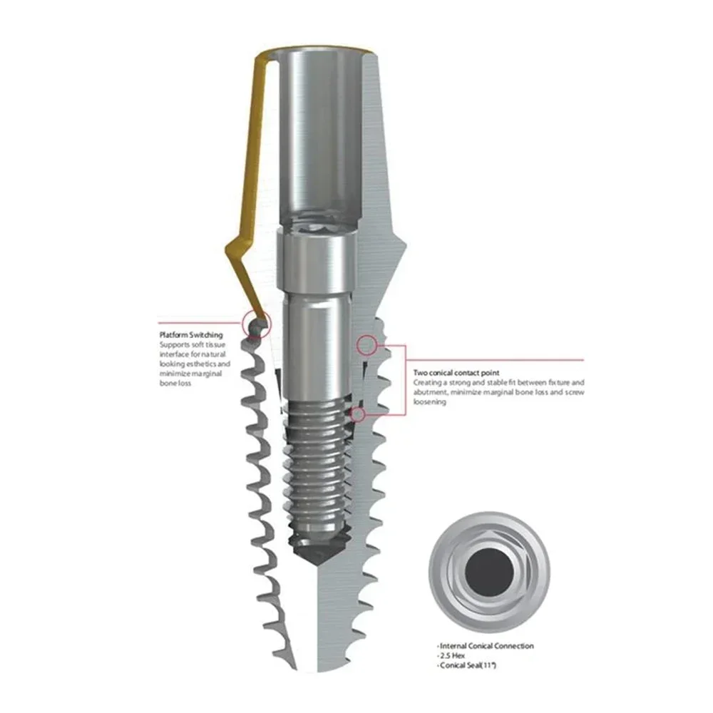 NeoBiotech IS‑III Active CMI Dental Implant, SLA Surface Internal Hex Titanium Fixture D3.0-5.0, D4.0×L10 Bone Level Restoration