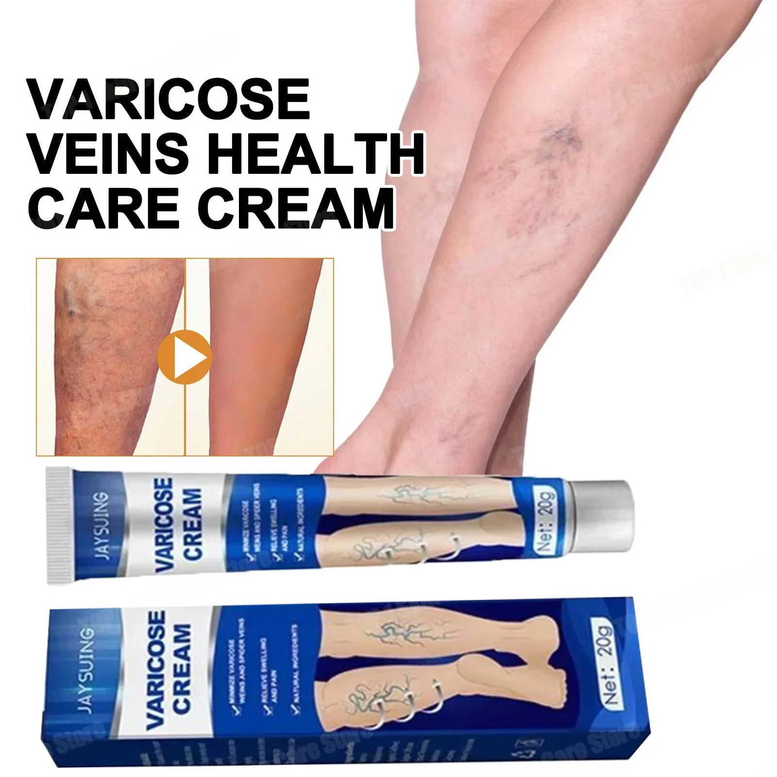 New Original Vasculitis Blood Circulation Varicose Veins Treatment New Cream 20g