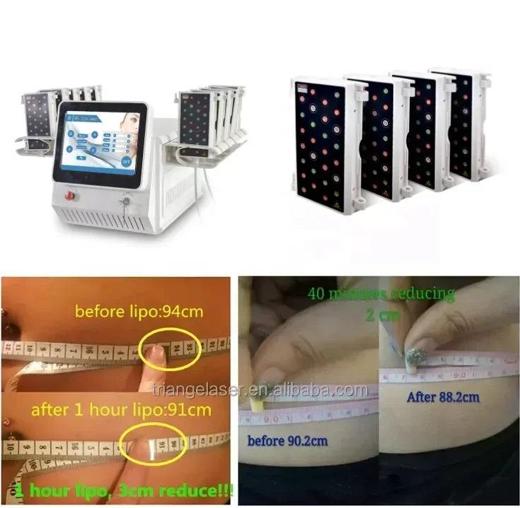 2025/equipamento lipo de cavitação lipo triangular