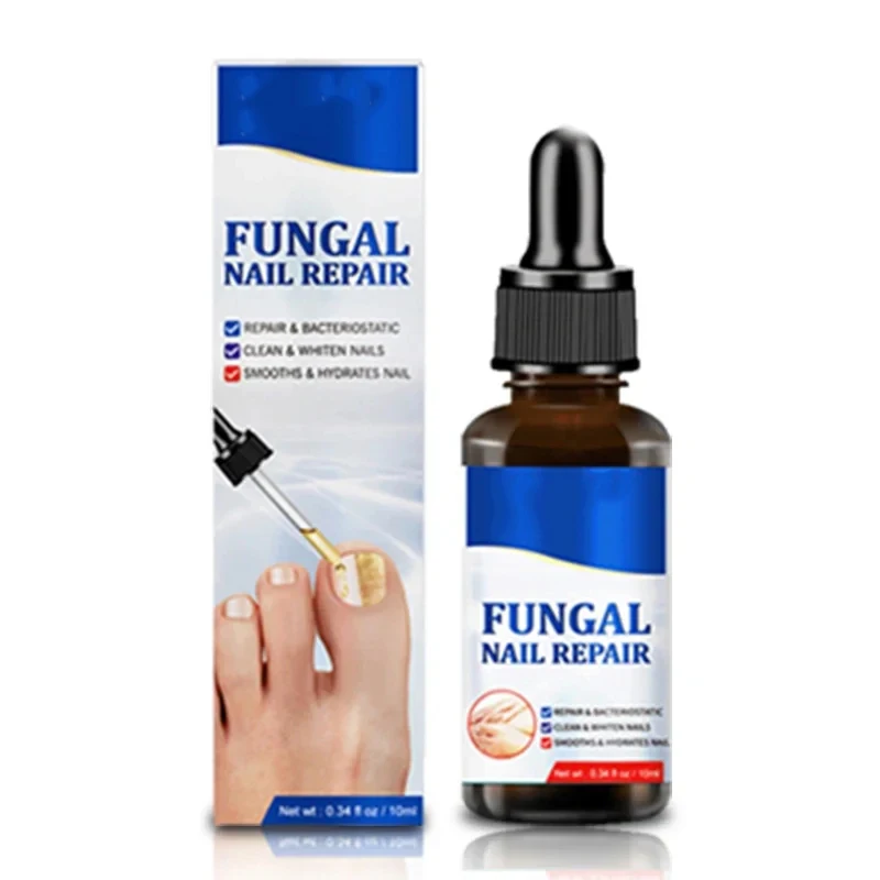 Nail Fungal Treatment Serum Onychomycosis Paronychia Anti Infection Toe Fungus Hand Foot Removal Repair Gel Care Beauty Health