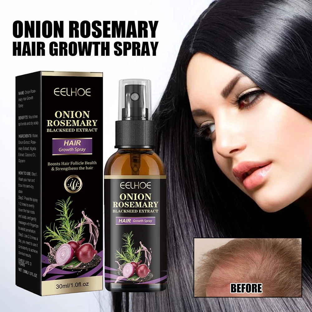 Onion Rosemary Hair Growth Serum Powered With Black Seed-Oil Controls Loss Promotes Growth Frizz Protection Hair Care Product