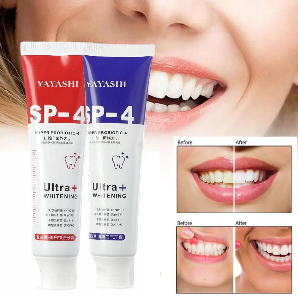 100/120g SP-4 Probiotic Whitening Shark Toothpaste Teeth Whitening Toothpaste Oral Care Toothpaste Fresh Breath Prevents Plaque