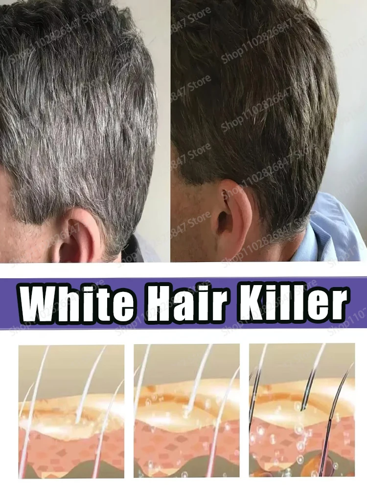 

White Hair Care - White Hairs Dyeing Serum Nutrition Enhancement White Hair to Black Hairs Care