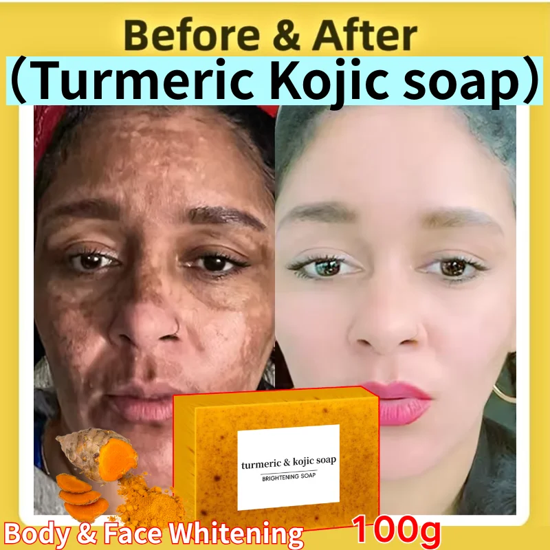 

Turmeric Kojic Acid Glow Soap Dark Spot Acne Removal Lighten Dark Skin Whiten Body Underarm Exfoliation Deep Clean Handmade Soap