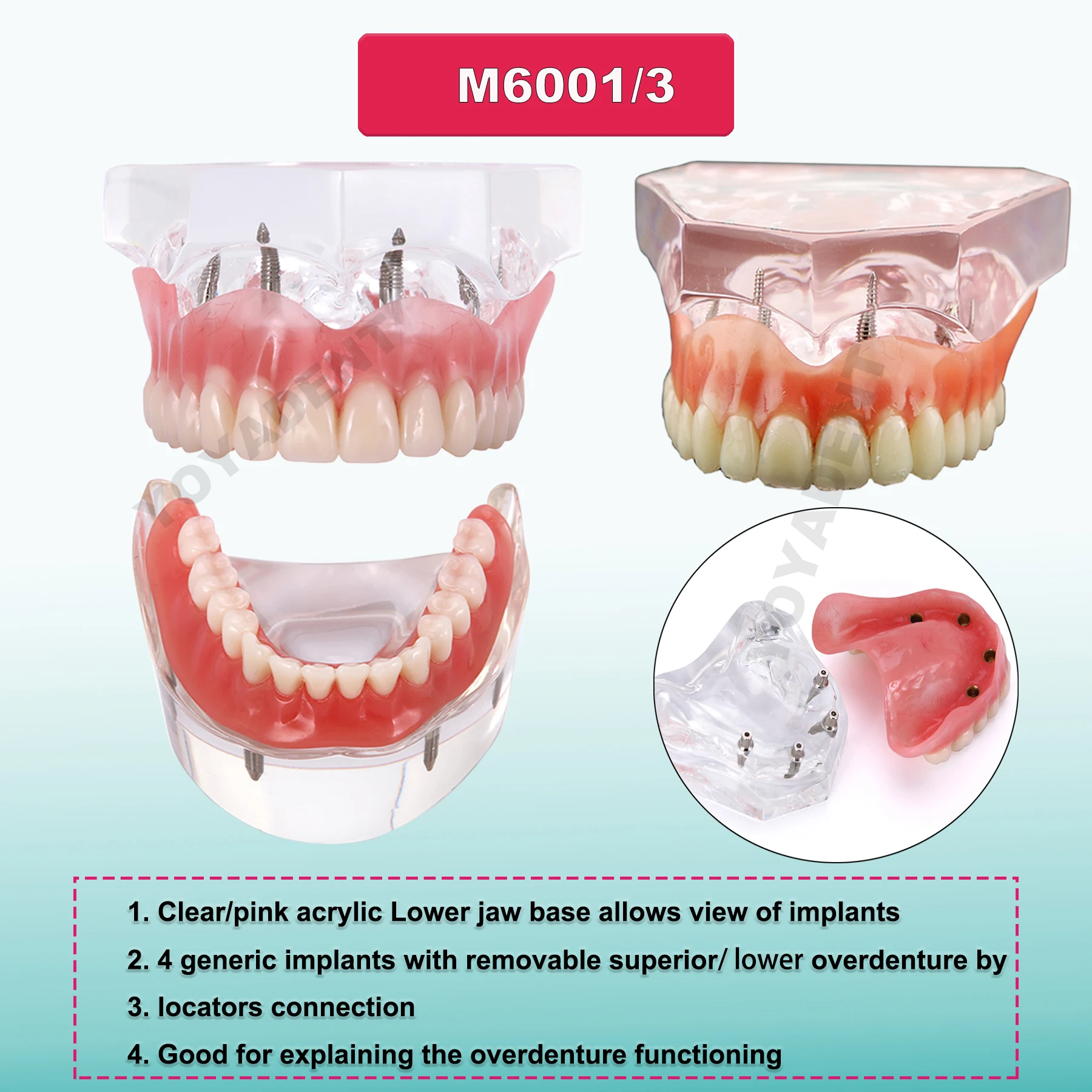 Multiple Types Dental Model Teeth Dental Teaching Models Study Orthodontic Removable Teeth Implant Models Dentist Material