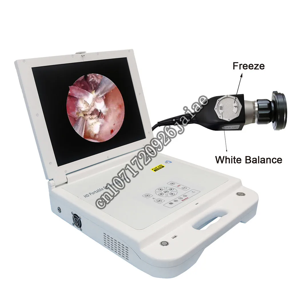 

Hot Sale 17 inches big screen HD Quality Portable ENT endoscope a with 80w LED light Source