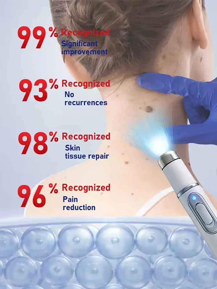 ثآليل مطورة من الجيل الثاني جذر الثآليل الإصلاح غير المؤلم بسرعة #6