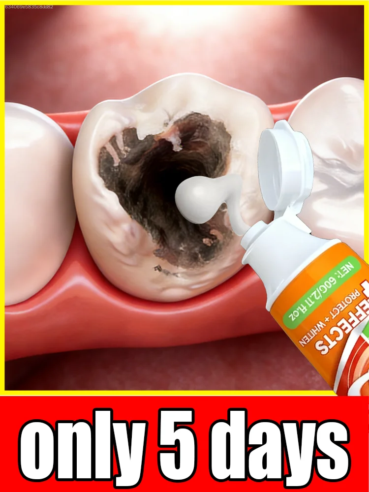 Home Use Teeth Care Toothpaste, Gentle Cleansing to Remove Surface Stains, Support Nice Teeth Look, Keep Refreshing Breath, Perfect for Everyday Adult Oral Cleaning Routine