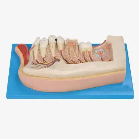 

Child Teeth Model,Anatomy Dental Model,Lower Jaw of 12-year-old