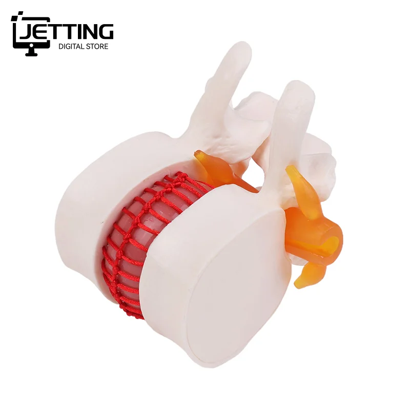 ✍ تشريح الإنسان الهيكل العظمي العمود الفقري قطني القرص فتق نموذج للتدريس الدماغ الجمجمة صدمة اللوازم المدرسية أداة طبية