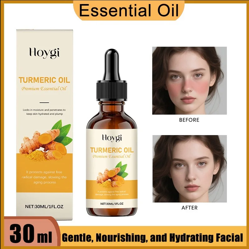 

30ML Turmeric Moisturizing Essential Oil - For Face & Neck | Hydrating | Non-Greasy | Nourishing Dry Skin Care Face Oil