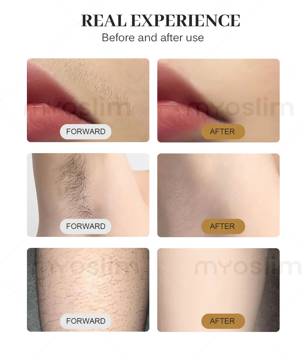 

Portable 808nm Diode Advanced Laser Beauty Device Permanent Hair Reduction CE Certification for Beauty Salon