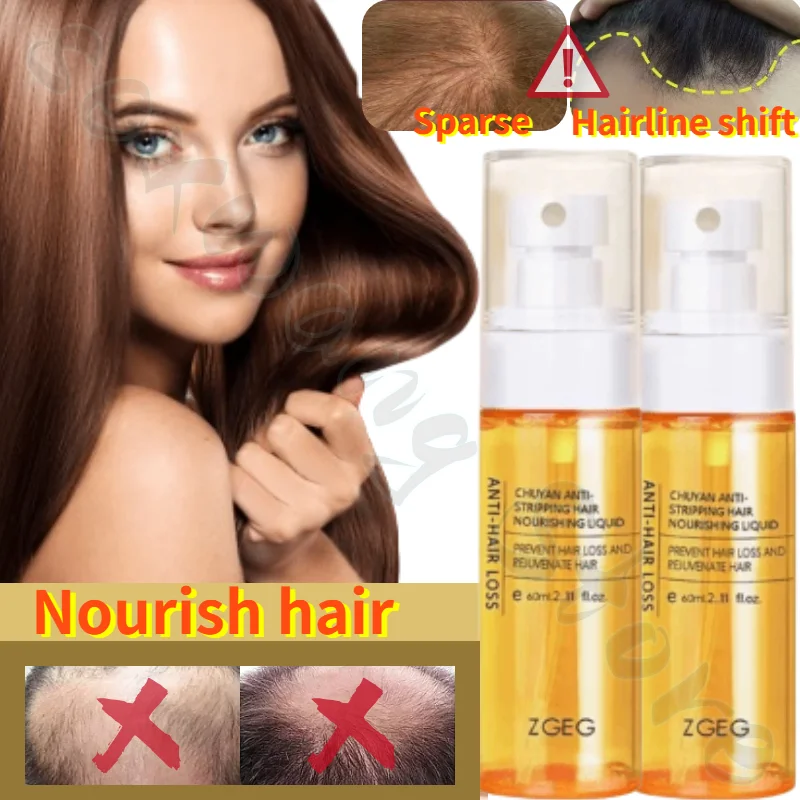 

ZGEG Hair Restoring Liquid Softens Hair Refreshes and Fluffs It Nourishes Damaged Hair Follicles and PromotesGrowth 60ml