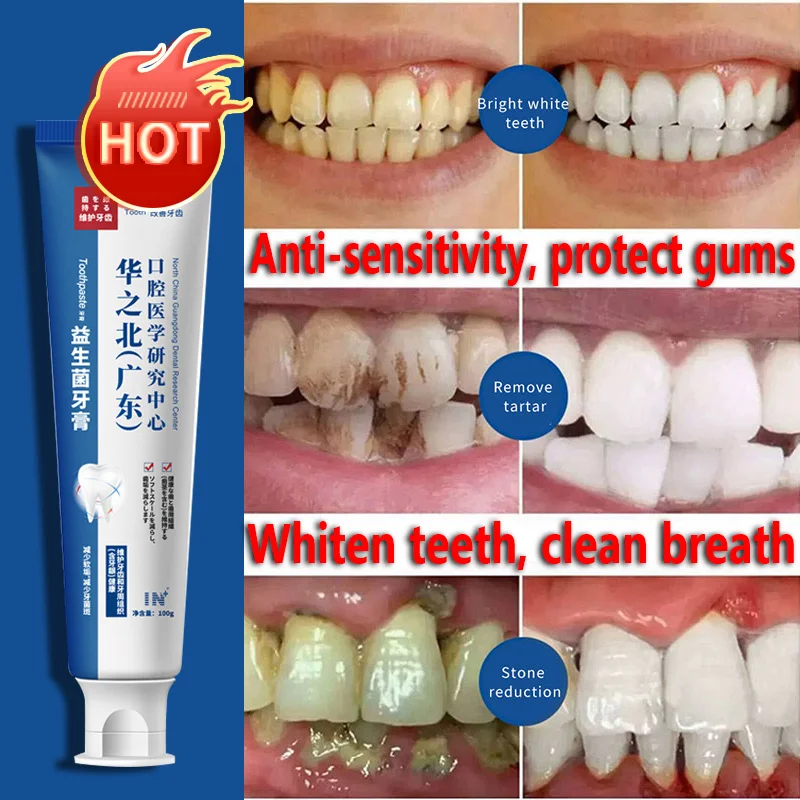 

2023 New Type Solve The Yellowing of Teeth Gum Discomfort Remove Plaque Tartar Repair Caries High-efficiency Toothpaste Whiten