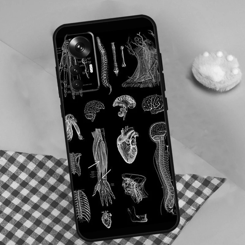 Radiological Human Organs Skeleton Case For Xiaomi 13 13T Pro 12T 11T 12 Lite 12X POCO X3 X5 Pro X4 F4 GT M5 M5s F3 F5 Funda