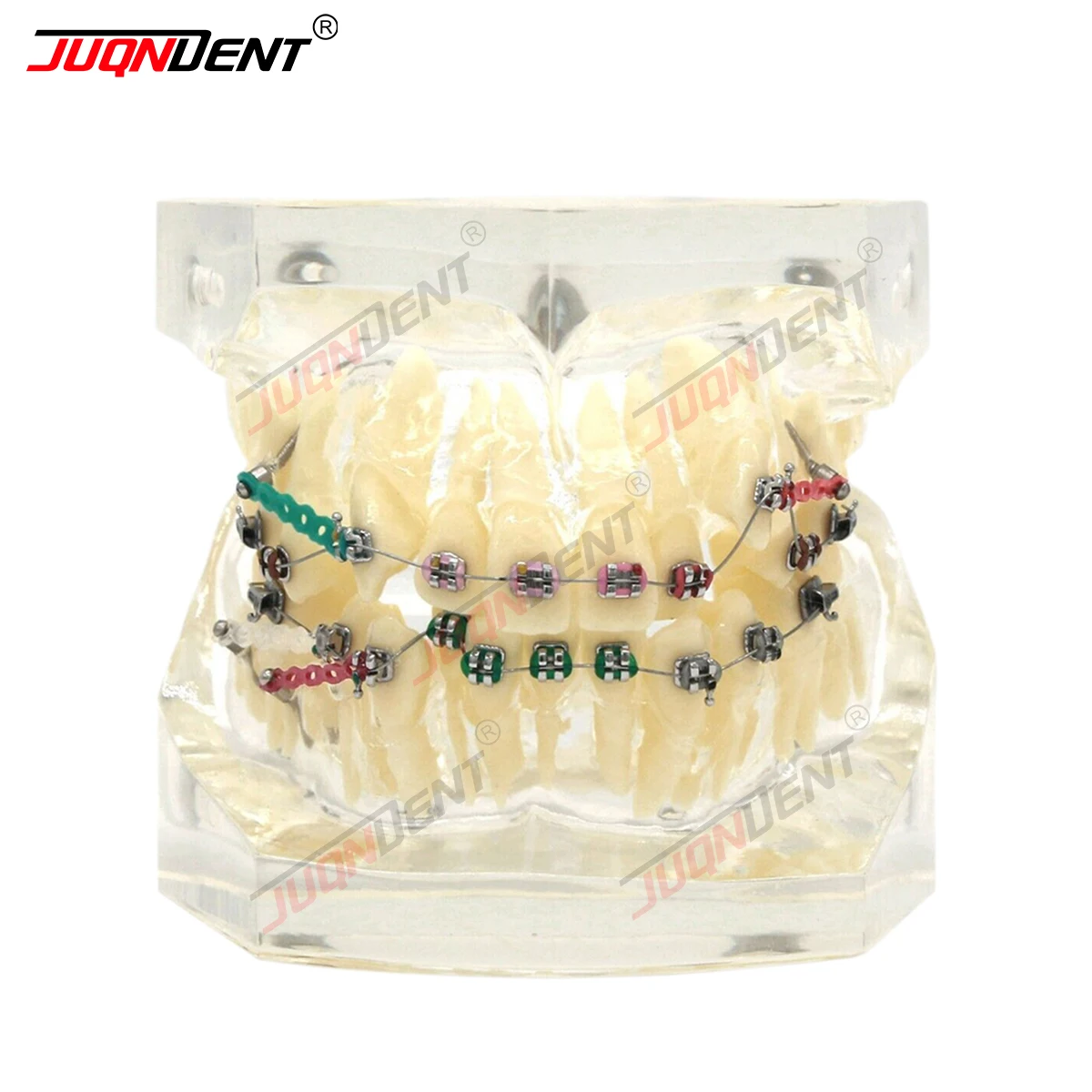 Dentel Model Dental Orthodontic Demonstration Practice Model Treatment Malocclusion With Brackets Chain Wire SG