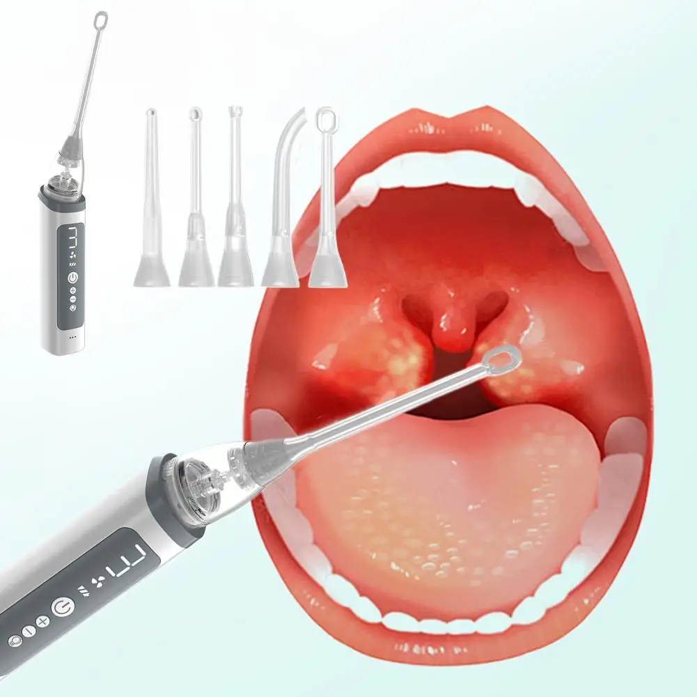 

Tonsil Stone Remover Tool, Tonsil Stone Removal Kit with Relief Bad Hygiene Vacuum Oral Suction Care Pump, Cleaner, Breath O2X6