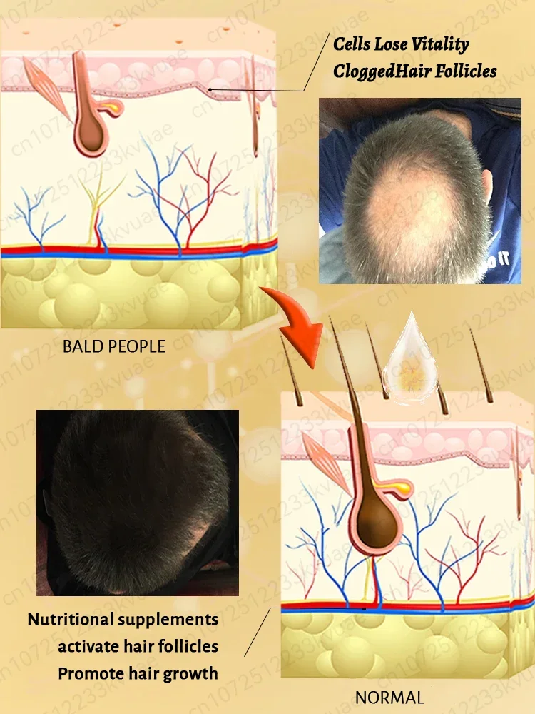 More and more hair, say goodbye to baldness