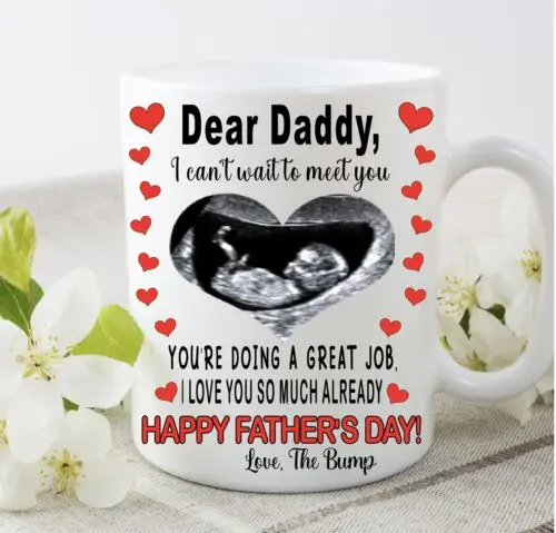 

Daddy Dad To Be Scan Photo Personalised Cup Mug Gift 1st Father’s Day Present