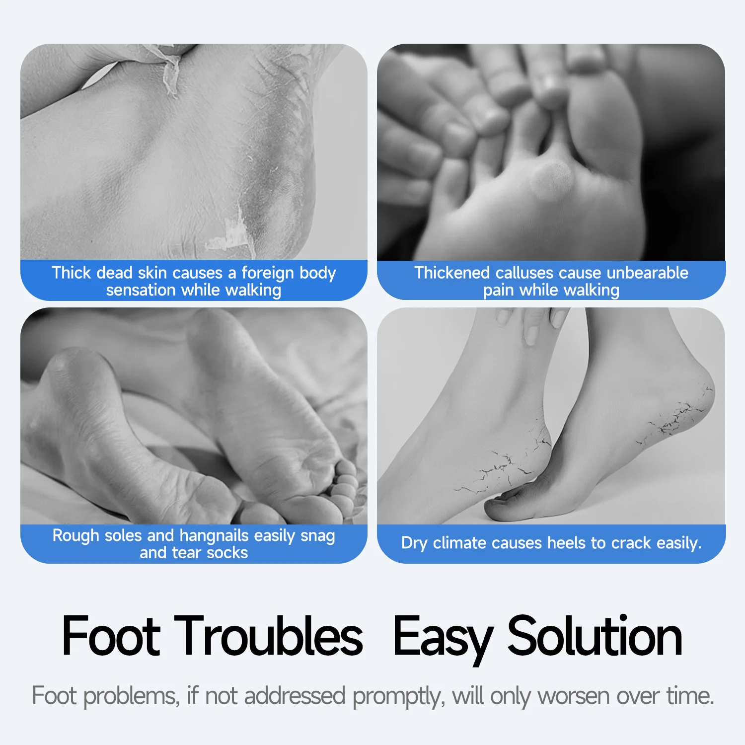 Thumbnail 4 - #14 Foot Scrubbers List of Top Picks