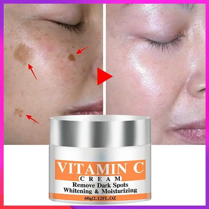 Mais novo vitamina c clareamento creme facial reparação fade sardas remover manchas escuras melanina removedor clareamento creme facial