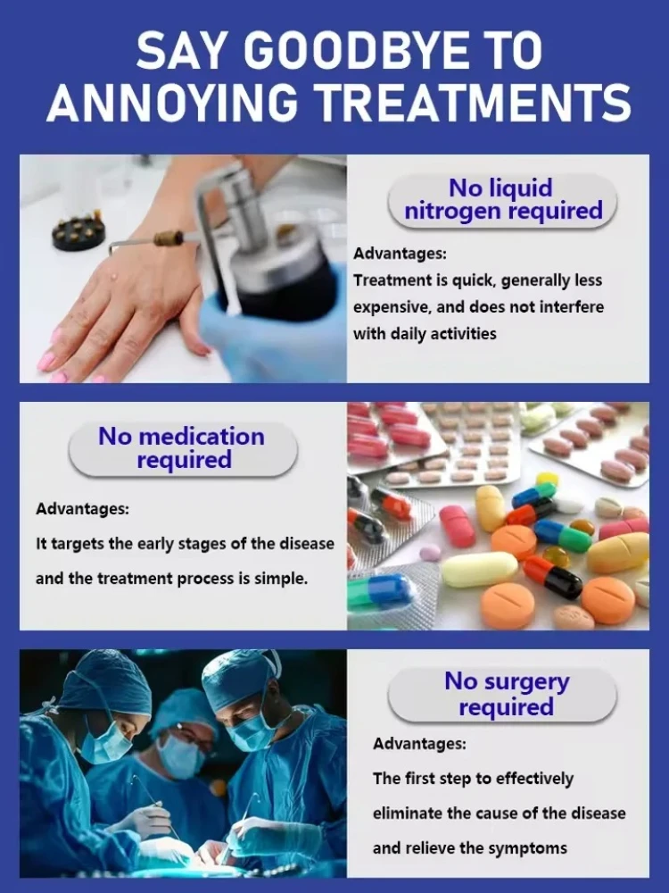 1a SSVerruca aggiornata di generazione riparazione verruche radice uick