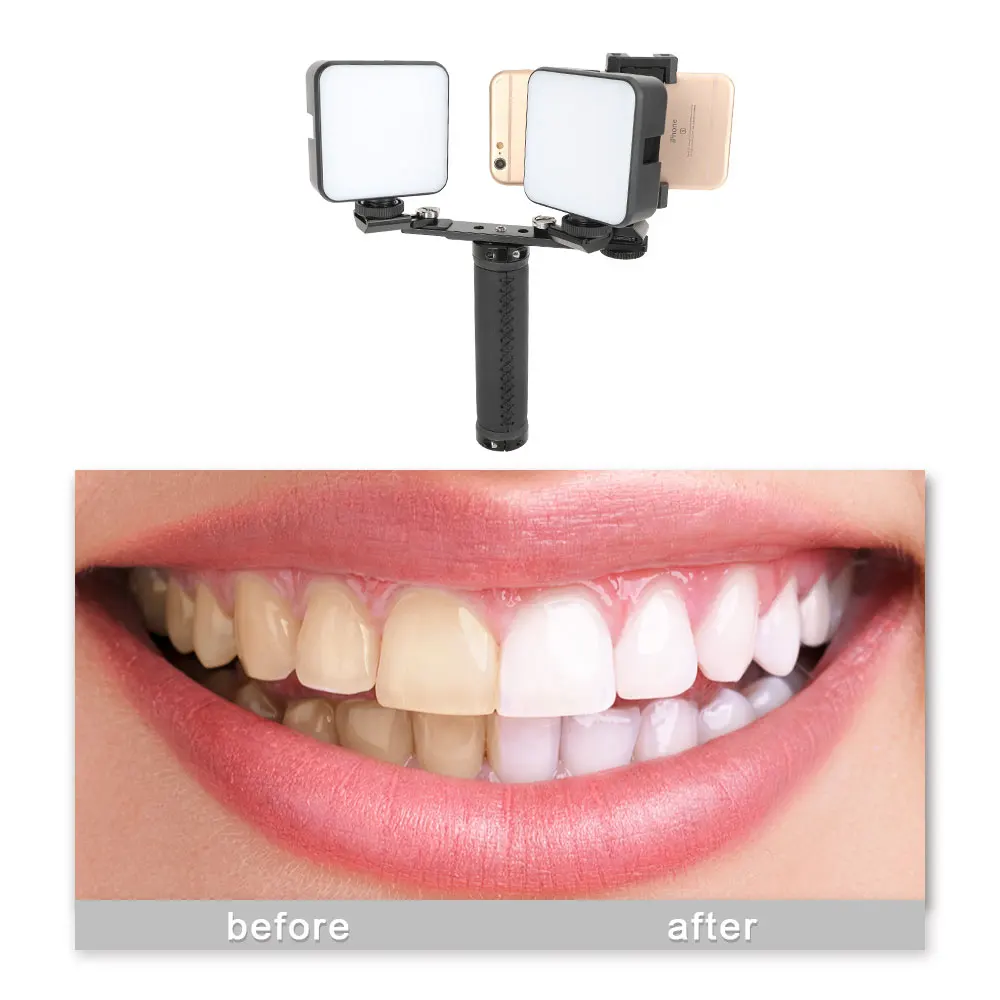 

Mobile Phone Photography Fill Light LED Oral Filling Lamp Dentist Treatment Photo Video Flashlight